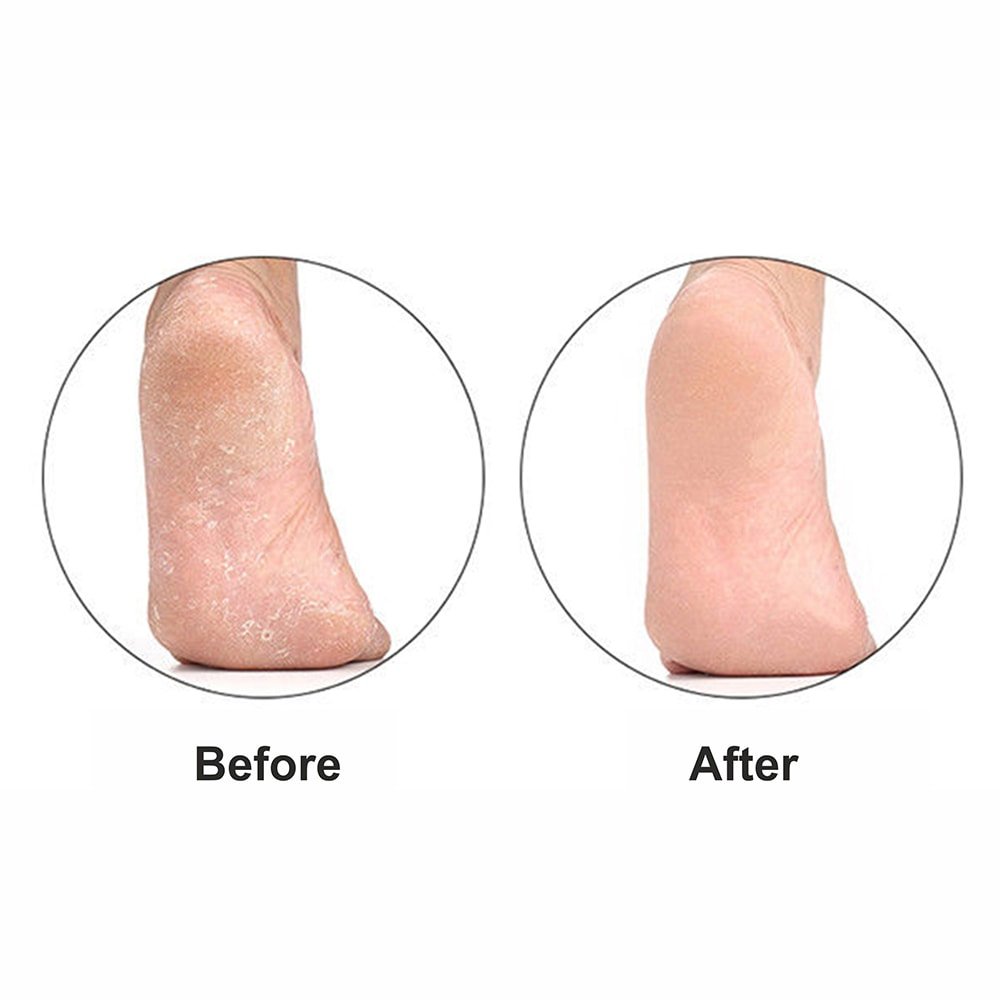 glam_foot_scraper_03